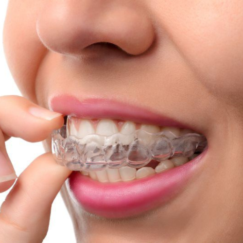 brightsmiledental - services Invisalign